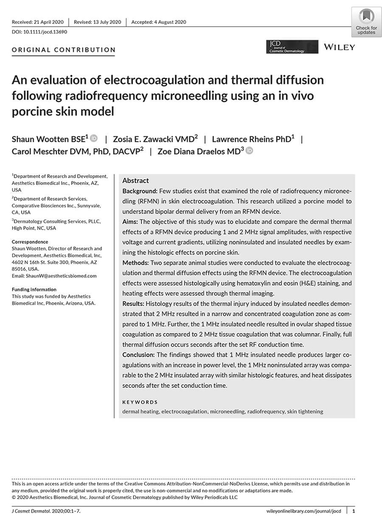 Wootten-et-al-An-evaluation-of-electrocoagulation-and-thermal-diffusion-following-radiofrequency